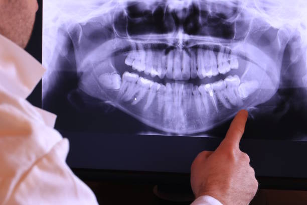 Best Dental Abscess Treatment in South Congaree, SC